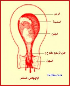 090223124227Hdg42