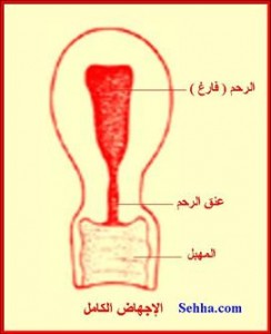 090223124228DNUi1