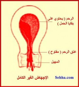 090223124228RtVm1
